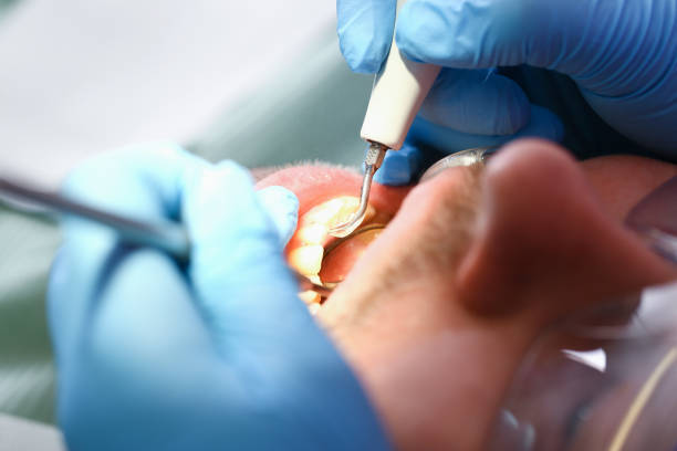 Trusted VT Emergency Dentist Experts